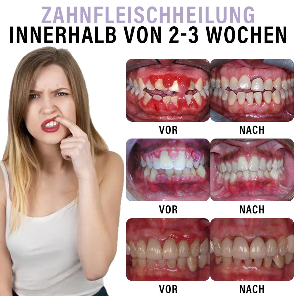 ✅Offizieller Shop |  Nelkenöl Mundpflege-Spray